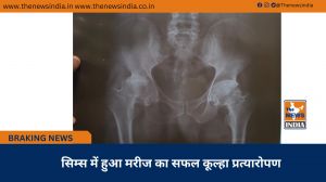 सिम्स में हुआ मरीज का सफल कूल्हा प्रत्यारोपण