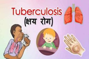  12 लाख लोगों की स्क्रीनिंग करने 1600 टीमें करेंगी टीबी रोगी की खोज