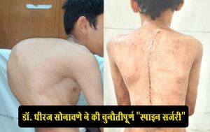  डॉ. धीरज सोनावणे ने की चुनौतीपूर्ण "स्पाइन सर्जरी"