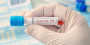 भारत में पिछले 24 घंटों में दर्ज हुए कोविड-19 के 74,442 नए मामले, 903 की मौत भारत में पिछले 24 घंटों में दर्ज हुए कोविड-19 के 74,442 नए मामले, 903 की मौत